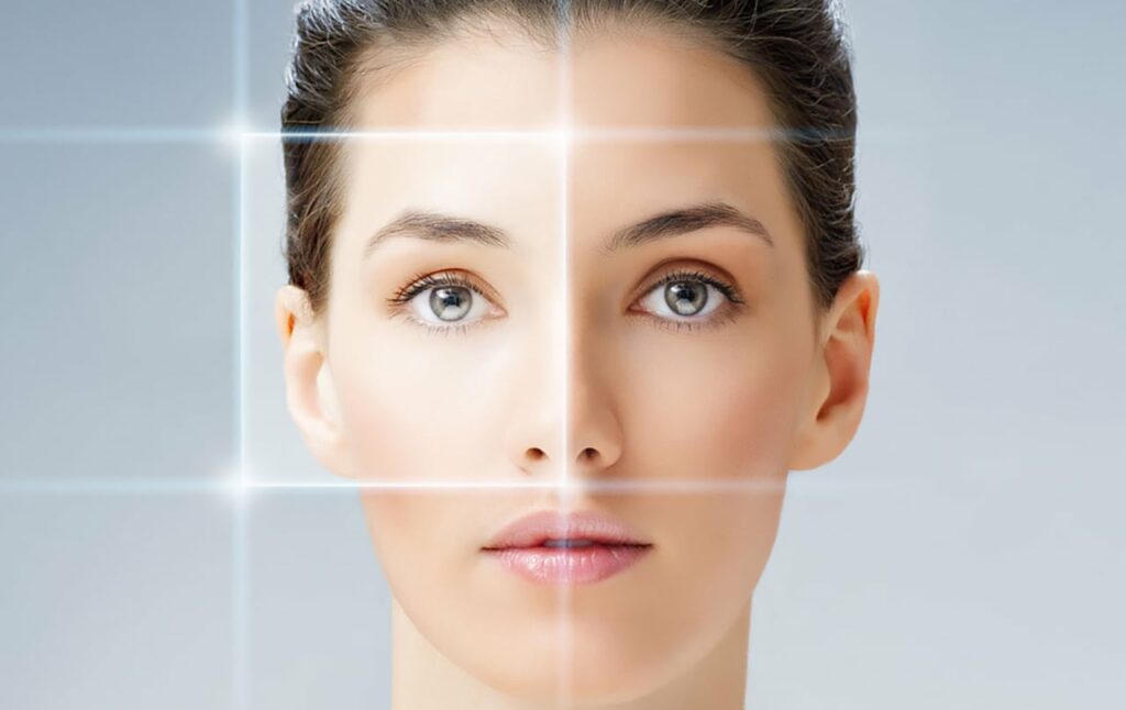 Gefäßlaser DermaV Rosazea Couperose Behandlung Fellbach